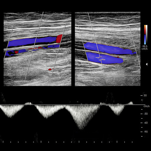 Oakstone Clinical Approach to Vascular Ultrasound and RPVI Prep Course 2026 Oakstone Clinical Approach to Vascular Ultrasound and RPVI Prep Course 2026
