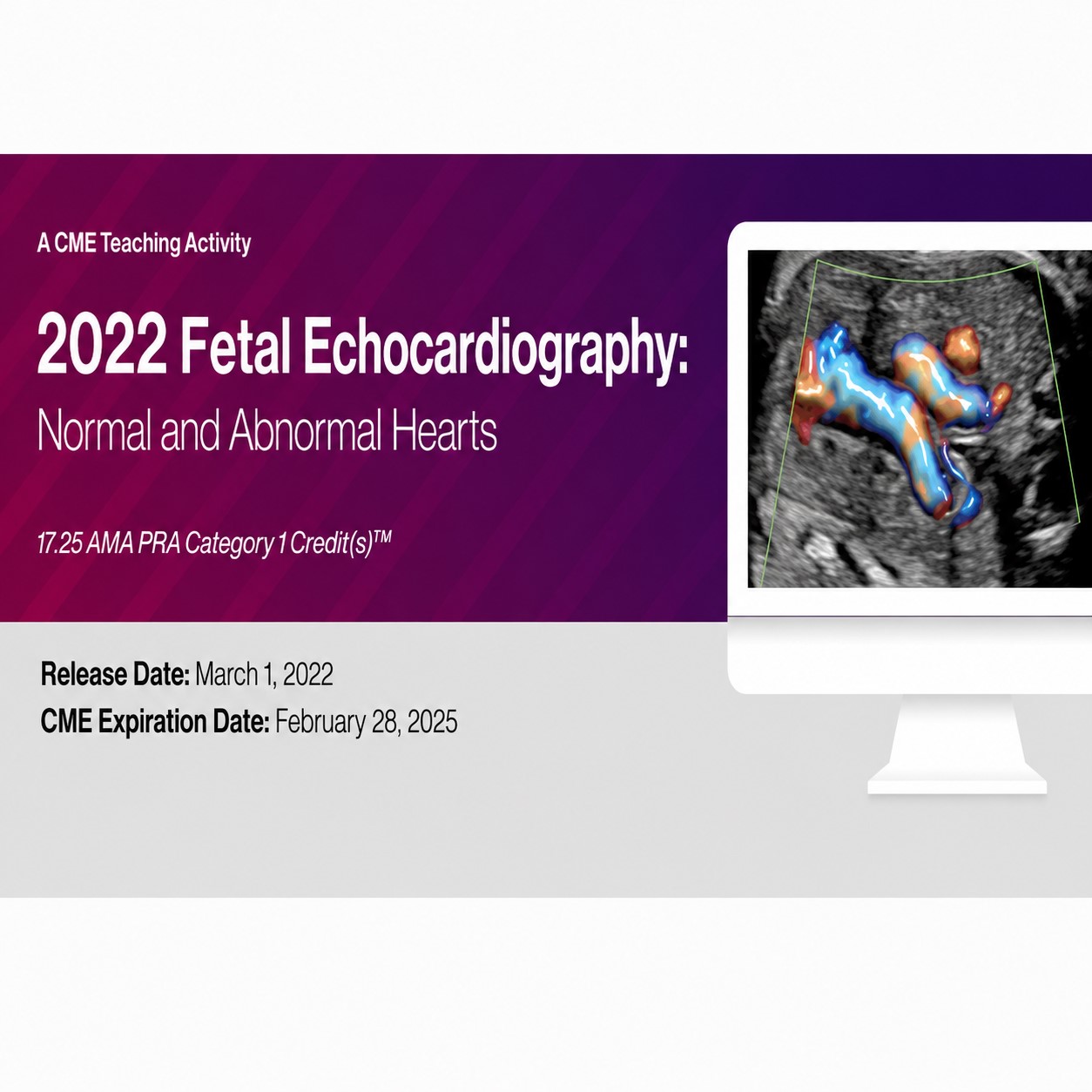 2022 Fetal Echocardiography Normal and Abnormal Hearts 2022 Fetal Echocardiography Normal and Abnormal Hearts