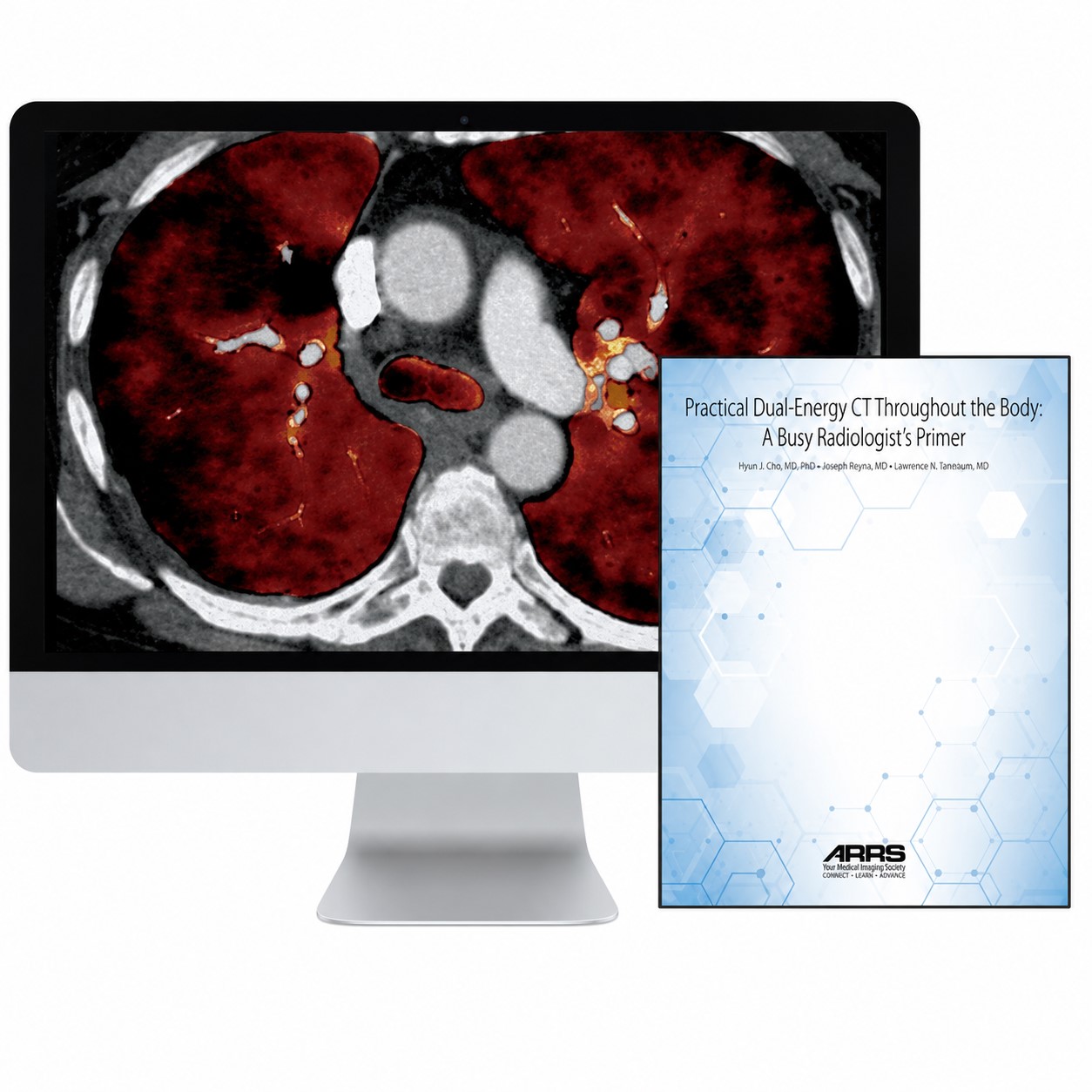 ARRS Practical Dual-Energy CT Throughout the Body 2021 ARRS Practical Dual-Energy CT Throughout the Body 2021