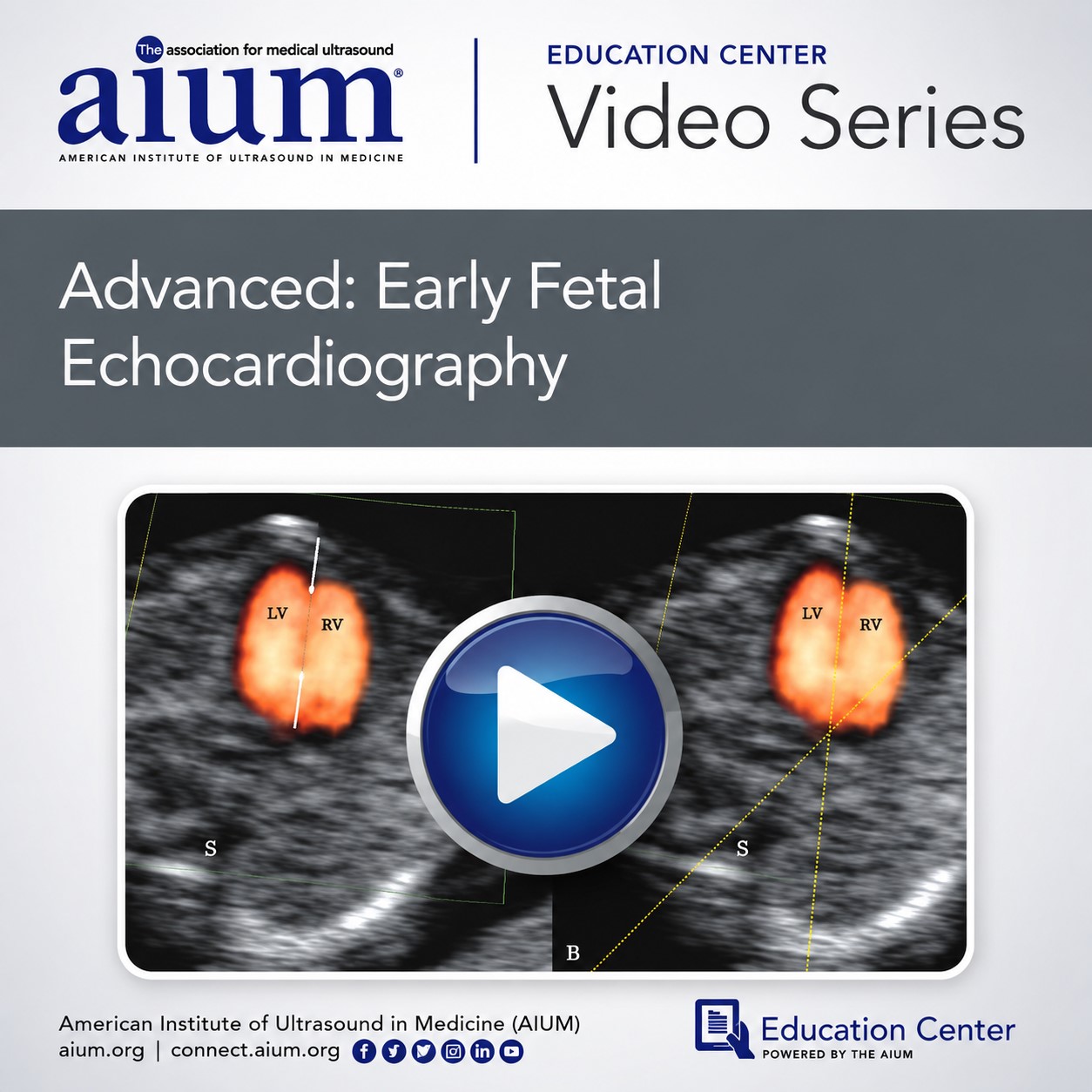 Advanced: Early Fetal Echocardiography Advanced: Early Fetal Echocardiography
