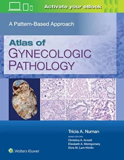 Atlas of Gynecologic Pathology: A Pattern-Based Approach (Original PDF from Publisher)