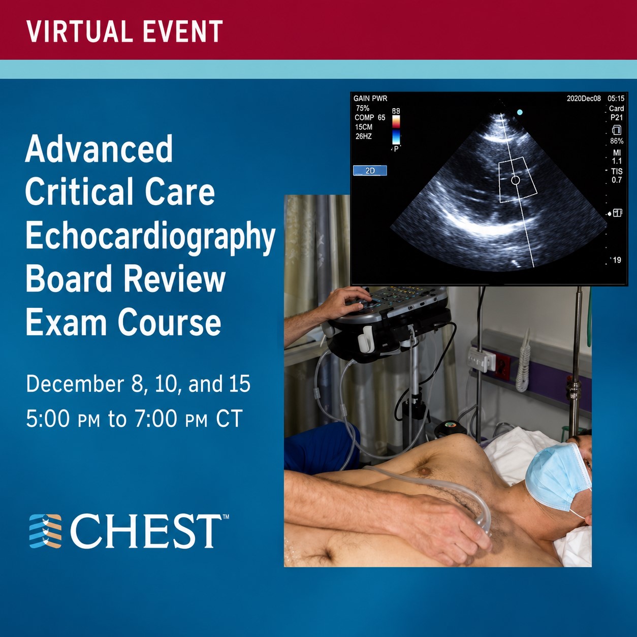 Chest advanced critical care echocardiography DECEMBER 2020 Chest advanced critical care echocardiography DECEMBER 2020