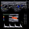 Clinical Approach to Vascular Ultrasound and RPVI Prep Course 2021 Clinical Approach to Vascular Ultrasound and RPVI Prep Course 2021