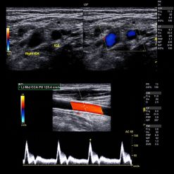 Clinical Approach to Vascular Ultrasound and RPVI Prep Course 2021
