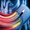 Comprehensive Review and Update of What’s New in Vascular and Endovascular Surgery 2021 Comprehensive Review and Update of What’s New in Vascular and Endovascular Surgery 2021