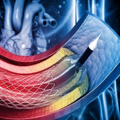 Comprehensive Review and Update of What’s New in Vascular and Endovascular Surgery 2021