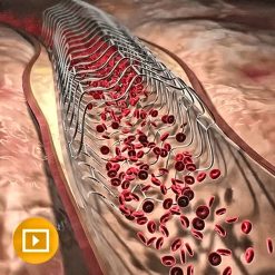 Comprehensive Review of Interventional Cardiology 2023