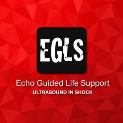 ECHO-Guided Life Support Using ultrasound to categorise shock and guide initial management