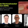 OHI-S Immediate Dentoalveolar Restoration (IDR) From Biological Principles to Predictable Clinical Outcomes 4 lessons 2h 43min OHI-S Immediate Dentoalveolar Restoration (IDR) From Biological Principles to Predictable Clinical Outcomes 4 lessons 2h 43min