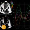 Oakstone Echocardiography A Comprehensive Review 2022