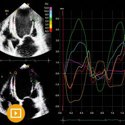 Oakstone Echocardiography A Comprehensive Review 2022