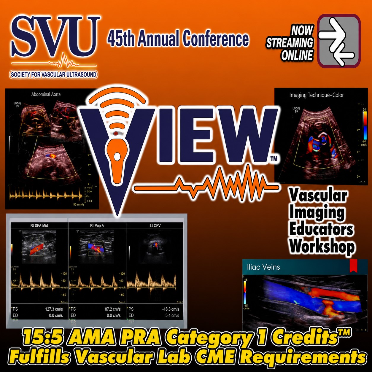 Society of Vascular Ultrasound 45th Annual Conference Society of Vascular Ultrasound 45th Annual Conference