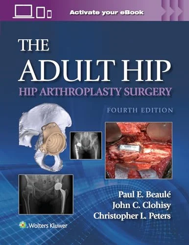 The Adult Hip: Hip Arthroplasty Surgery, 4th Edition (Videos) The Adult Hip: Hip Arthroplasty Surgery, 4th Edition (Videos)