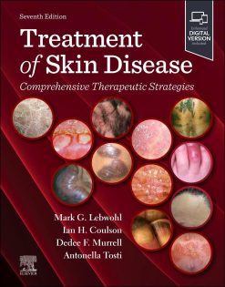 Treatment of Skin Disease Comprehensive Therapeutic Strategies, 7th Edition (Original PDF from Publisher)