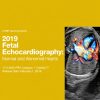 2019 Fetal Echocardiography: Normal and Abnormal Hearts
