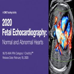2020 Fetal Echocardiography Normal and Abnormal Hearts
