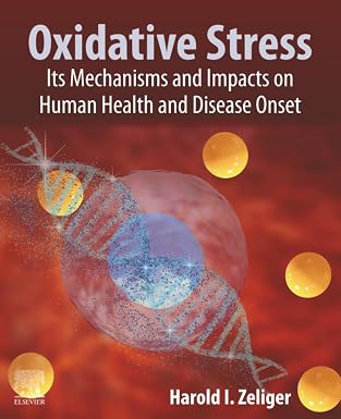 Oxidative Stress: Its Mechanisms and Impacts on Human Health and Disease Onset Oxidative Stress: Its Mechanisms and Impacts on Human Health and Disease Onset