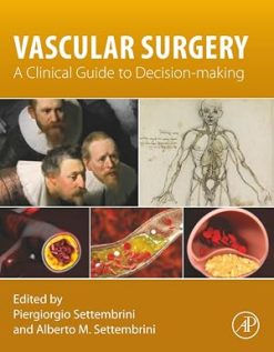 Vascular Surgery: A Clinical Guide to Decision-making