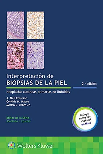 Interpretación de biopsias de la piel: Neoplasias cutáneas primarias no linfoides, 2a edición (Original PDF from Publisher) Interpretación de biopsias de la piel: Neoplasias cutáneas primarias no linfoides, 2a edición (Original PDF from Publisher)