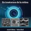 OCT y OCTA en trastornos de la retina (Spanish Edition) (Original PDF from Publisher) OCT y OCTA en trastornos de la retina (Spanish Edition) (Original PDF from Publisher)