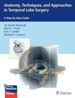 Anatomy, Techniques, and Approaches in Temporal Lobe Surgery: A Step-by-Step Guide (Original PDF from Publisher+Videos)