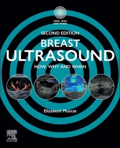 Breast Ultrasound: How, Why and When, 2nd edition (EPUB)