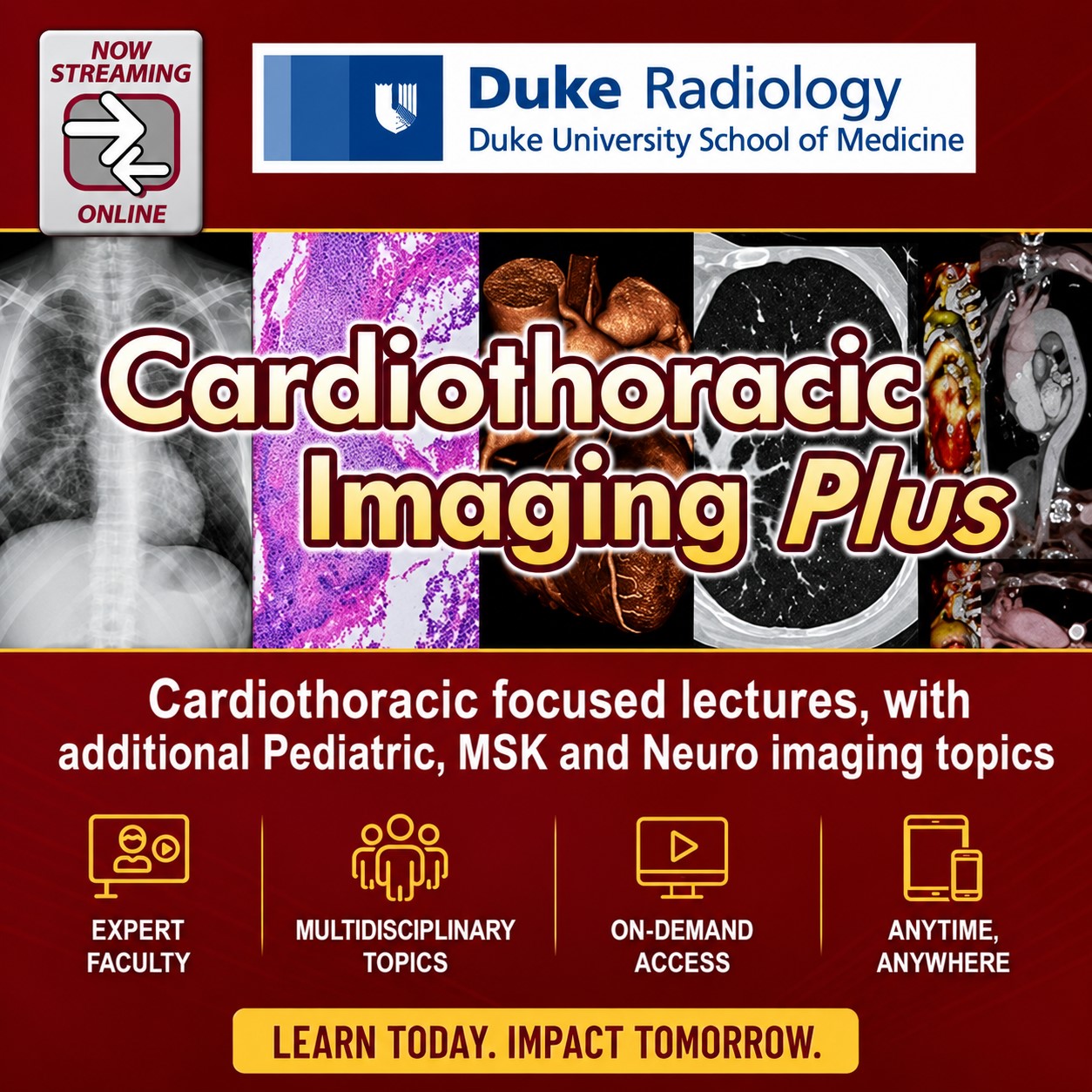 Duke Radiology Cardiothoracic Imaging Plus 2016 Duke Radiology Cardiothoracic Imaging Plus 2016