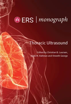 ERS Monographs: Thoracic Ultrasound (Original PDF from Publisher)