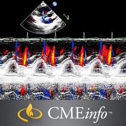 Echocardiography – A Comprehensive Review 2020