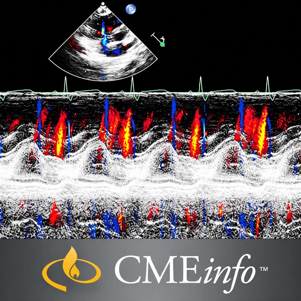 Echocardiography – A Comprehensive Review 2020 Echocardiography – A Comprehensive Review 2020