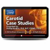 Gulfcoast Carotid Case Studies (Videos+PDFs)