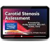 Gulfcoast Carotid Stenosis Assessment (Videos+PDFs) Gulfcoast Carotid Stenosis Assessment (Videos+PDFs)