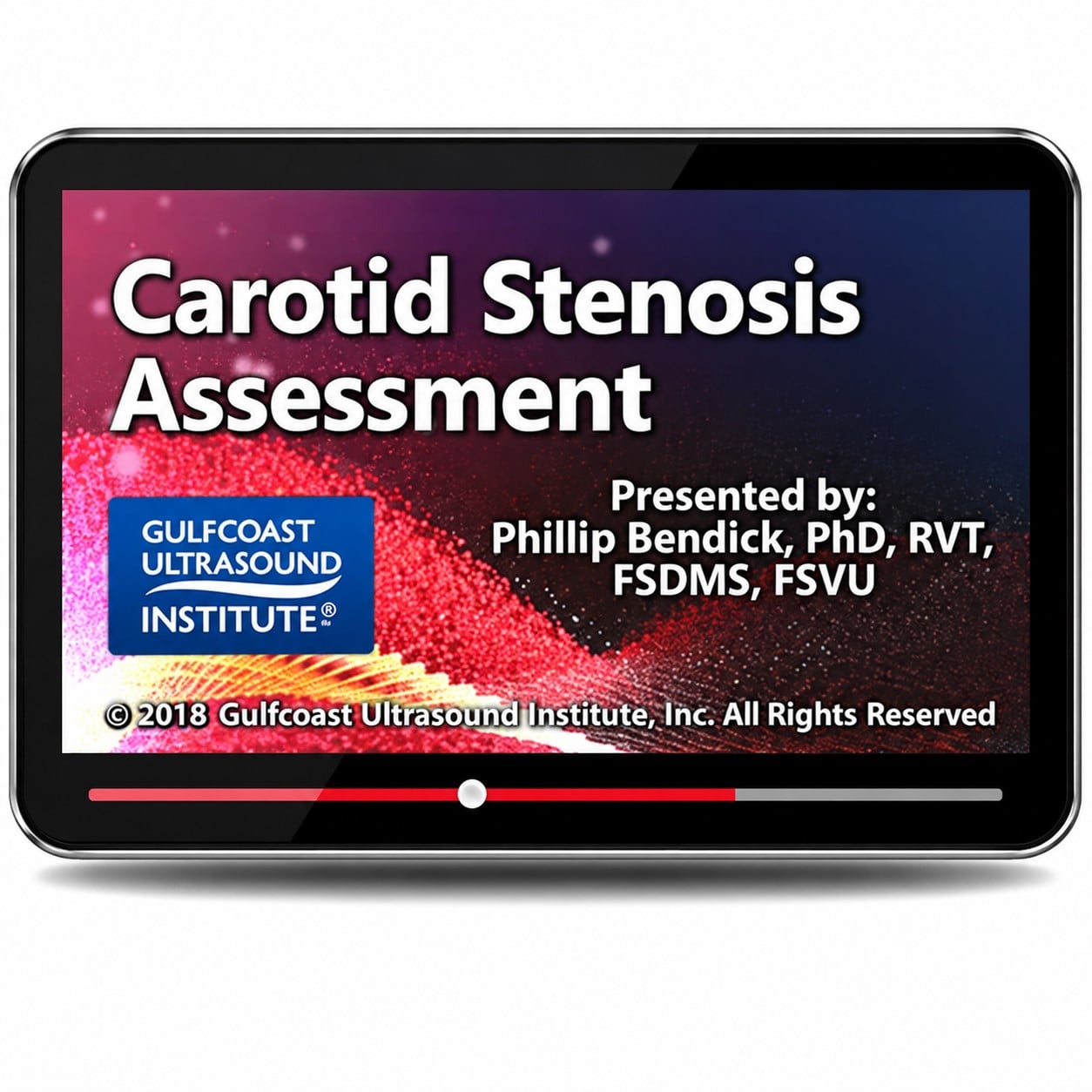 Gulfcoast Carotid Stenosis Assessment (Videos+PDFs) Gulfcoast Carotid Stenosis Assessment (Videos+PDFs)