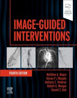 Image-Guided Interventions (Expert Radiology), 4th edition (EPUB)