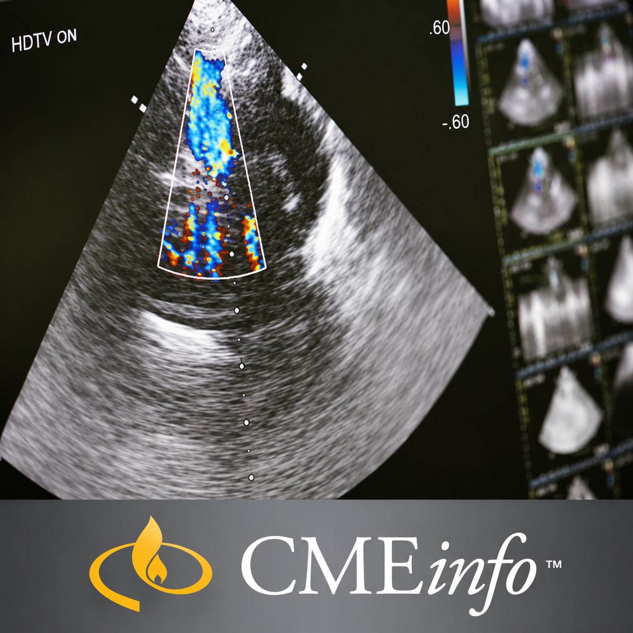 Intensive Vascular Ultrasound Interpretation Review and Registry Preparation 2018 Intensive Vascular Ultrasound Interpretation Review and Registry Preparation 2018