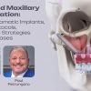 OHI-S Advanced Maxillary Rehabilitation Guided Zygomatic Implants, All-on-X Protocols, and Rescue Strategies for Failed Cases 3 lessons 3h 21min OHI-S Advanced Maxillary Rehabilitation Guided Zygomatic Implants, All-on-X Protocols, and Rescue Strategies for Failed Cases 3 lessons 3h 21min