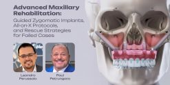 OHI-S Advanced Maxillary Rehabilitation Guided Zygomatic Implants, All-on-X Protocols, and Rescue Strategies for Failed Cases 3 lessons 3h 21min