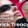 OHI-S CO₂ Laser Resurfacing for Face and Hands 3 lessons 33min