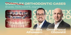 OHI-S Complex Orthodontic Cases. Braces, TADs, MARPE, Aligners
