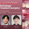 OHI-S Complications in Periodontology and Peri-implant Surgery Prevention, Diagnosis, and Management – All in One Place 5 lessons 4h 33min