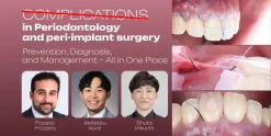 OHI-S Complications in Periodontology and Peri-implant Surgery Prevention, Diagnosis, and Management – All in One Place 5 lessons 4h 33min