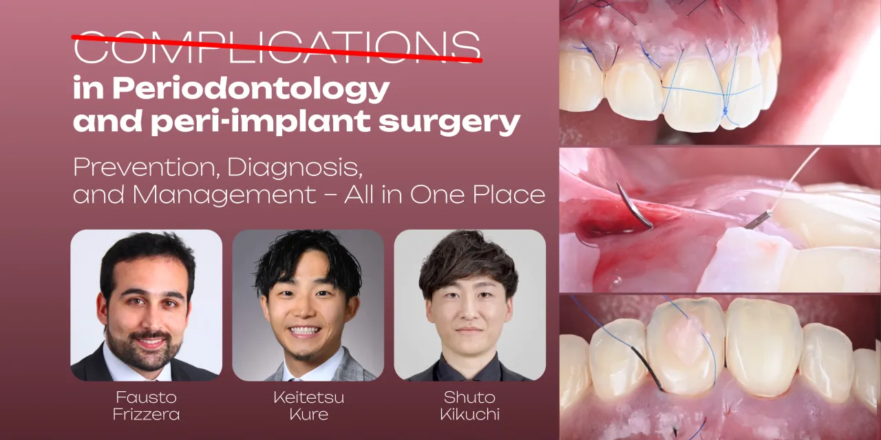 OHI-S Complications in Periodontology and Peri-implant Surgery Prevention, Diagnosis, and Management – All in One Place 5 lessons 4h 33min OHI-S Complications in Periodontology and Peri-implant Surgery Prevention, Diagnosis, and Management – All in One Place 5 lessons 4h 33min