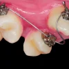 OHI-S OrthoEvolution 2.0 4 lessons 7h 41min