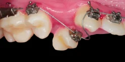 OHI-S OrthoEvolution 2.0 4 lessons 7h 41min