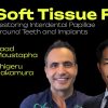 OHI-S Soft Tissue First. Restoring Interdental Papillae Around Teeth and Implants 4 lessons 2h 11min