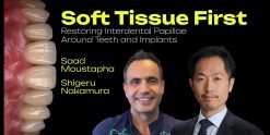 OHI-S Soft Tissue First. Restoring Interdental Papillae Around Teeth and Implants 4 lessons 2h 11min