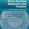 Pelvic Fracture Reduction and Fixation: Technical Aspects and Principles (EPUB) Pelvic Fracture Reduction and Fixation Technical Aspects and Principles (EPUB)
