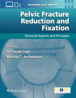 Pelvic Fracture Reduction and Fixation Technical Aspects and Principles (EPUB)