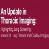 Updates in Thoracic Imaging Highlighting Lung Screening, Interstitial Lung Disease, and Cardiac Imaging 2020 Updates in Thoracic Imaging Highlighting Lung Screening, Interstitial Lung Disease, and Cardiac Imaging 2020