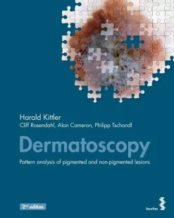 Dermatoscopy: Pattern analysis of pigmented and non-pigmented lesions, 2nd edition (Original PDF from Publisher)